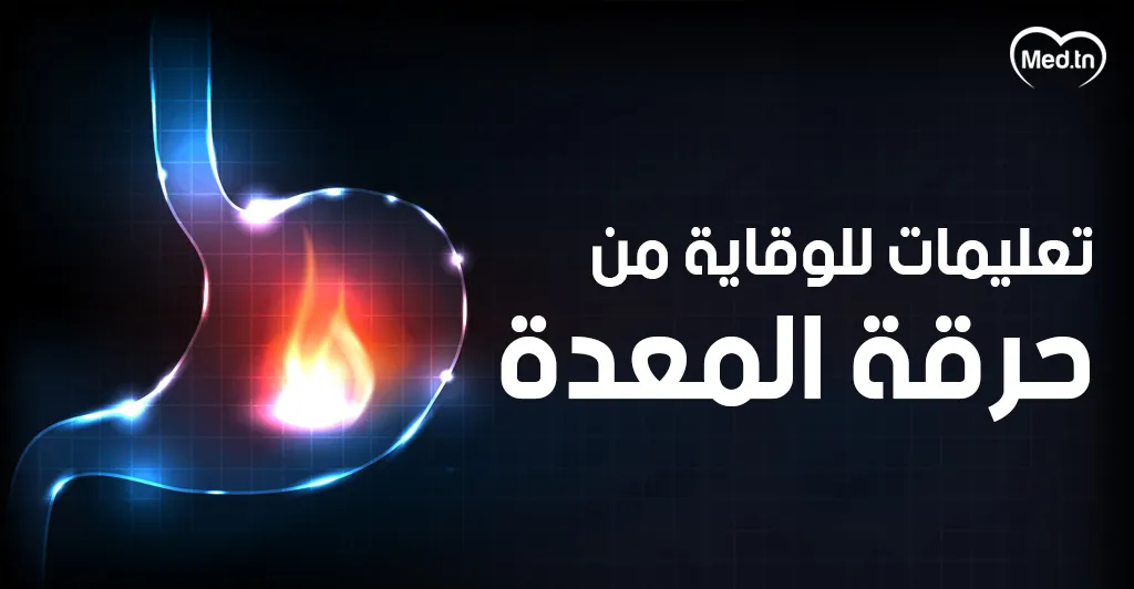 تعليمات للوقاية من حرقة المعدة