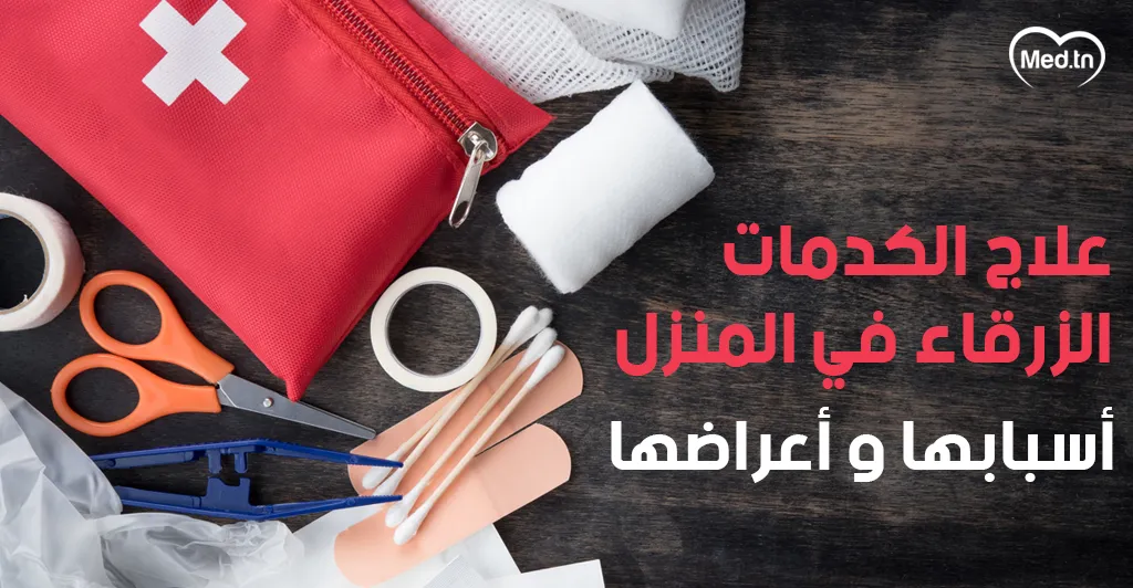 علاج الكدمات الزرقاء في المنزل .. وأسبابها وأعراضها