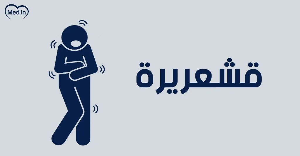 ما هي أعراض عرق النسا  