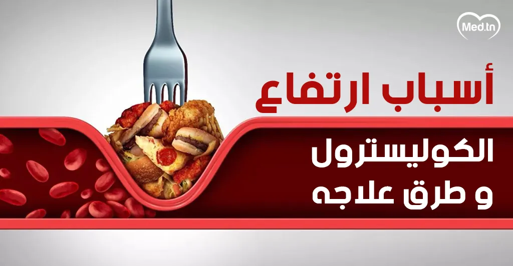 أسباب ارتفاع الكوليسترول وطرق علاجه