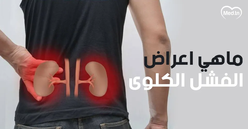 ماهي أعراض الفشل الكلوى؟