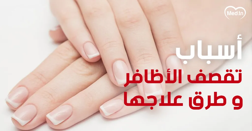 أسباب تقصف الأظافر وطرق علاجها