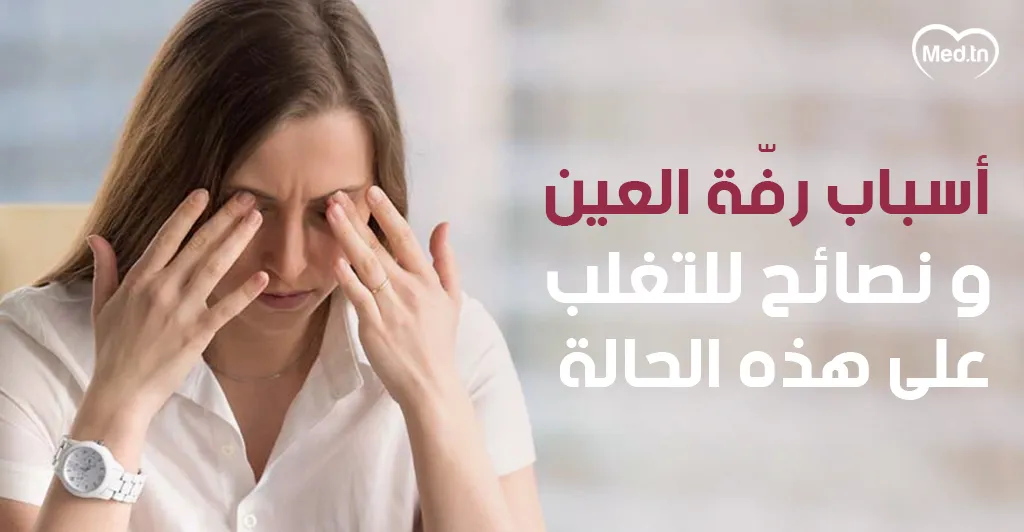 أسباب رفة العين ونصائح للتغلب على هذه الحالة 