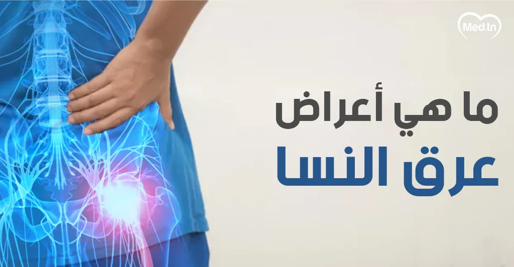 ما هي أعراض عرق النسا  