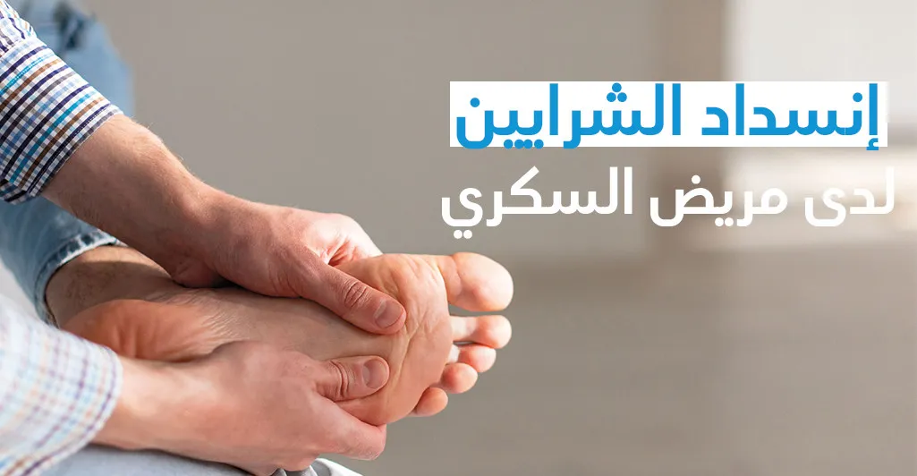 إنسداد الشّرايين لدى مريض السّكّري ( إعتلال شرايين الأطراف السّفلى)