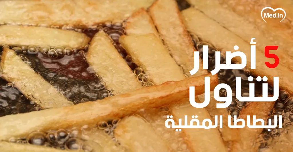 5 أضرار لتناول البطاطا المقلية