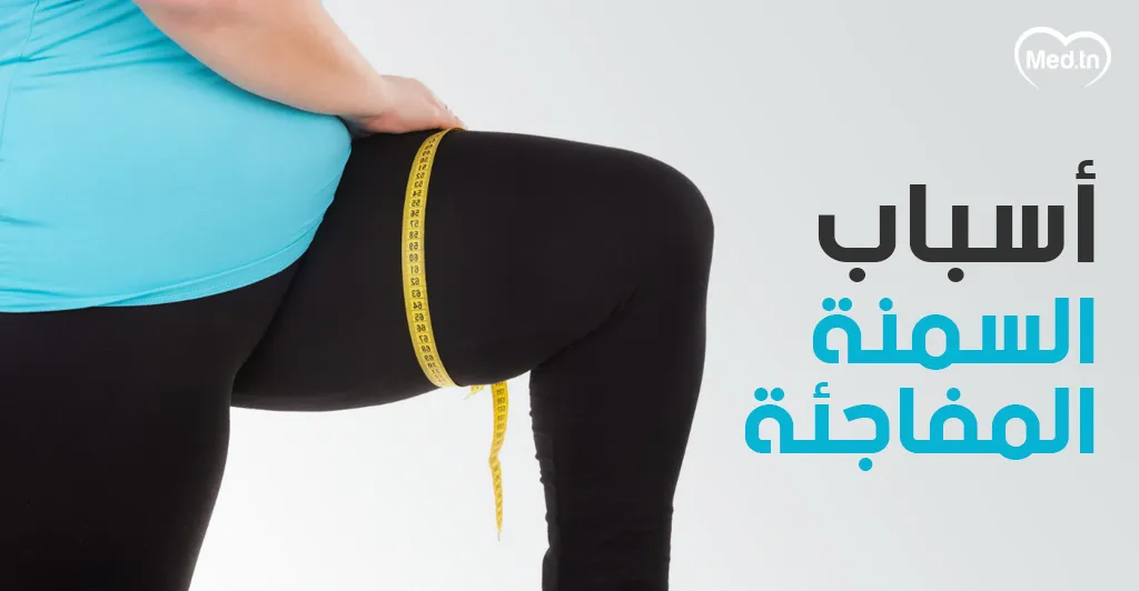 أسباب السمنة المفاجئة