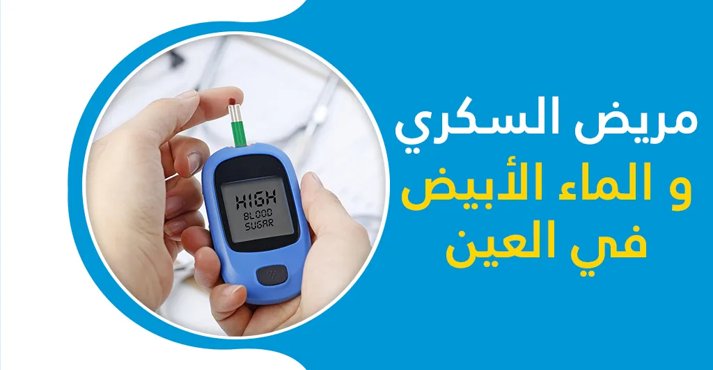 الماء الابيض في العين علاماته و الحالات التي تستوجب العلاج سريعا