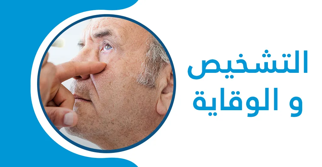 الماء الابيض في العين علاماته و الحالات التي تستوجب العلاج سريعا