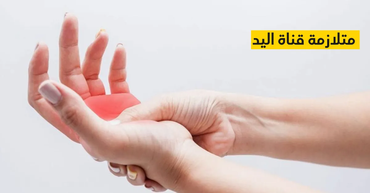 متلازمة قناة اليد