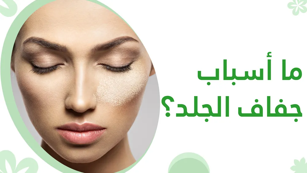ما أسباب جفاف الجلد