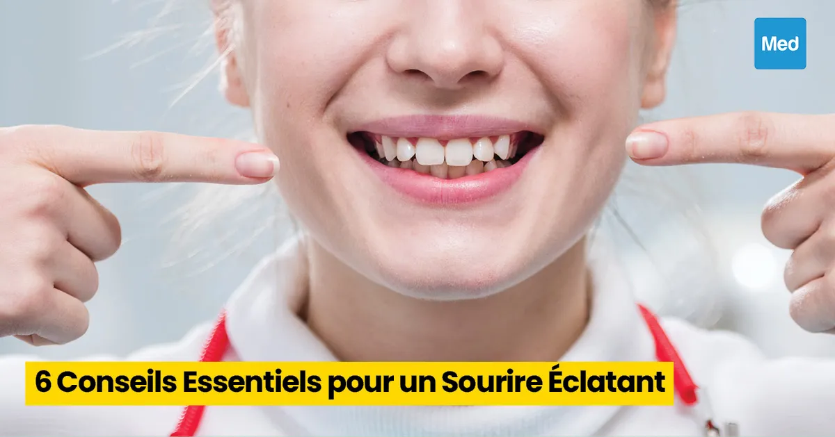 6 Conseils Essentiels pour un Sourire Éclatant