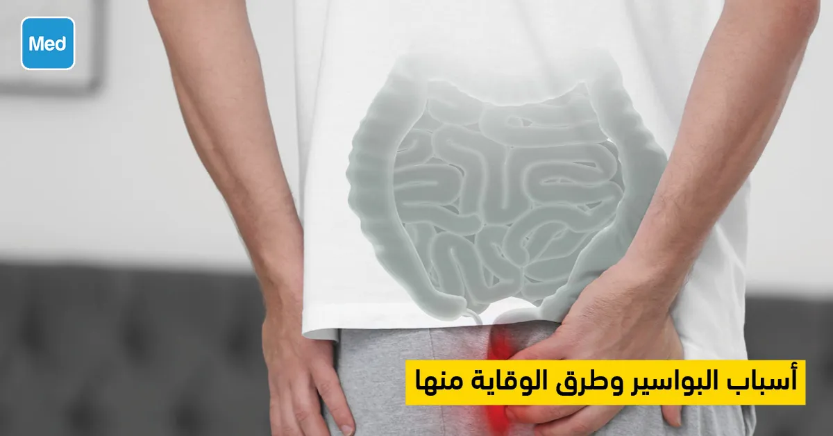 أسباب البواسير وطرق الوقاية منها