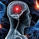 Dr Mati M Neurologist