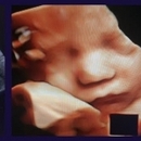 Dr Naïma ep.Azizou Belouz Gynécologue Obstétricien