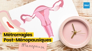 Métrorragies Post-Ménopausiques : Les Signaux d'Alerte Importants