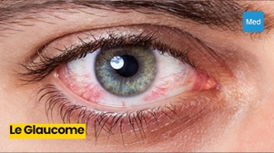 Comprendre le Glaucome : Enjeux, Symptômes et Prévention