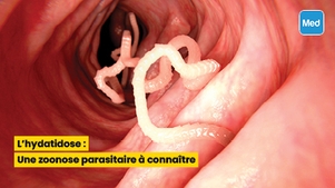 L'hydatidose : Une zoonose parasitaire à connaître