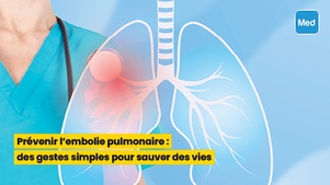 Prévenir l'embolie pulmonaire : des gestes simples pour sauver des vies