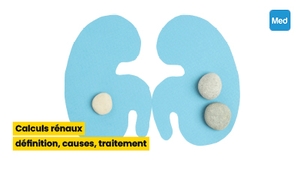 Calculs rénaux : définition, causes, traitement