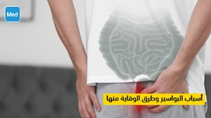 أسباب البواسير وطرق الوقاية منها