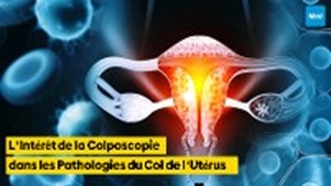 L'Intérêt de la Colposcopie dans les Pathologies du Col de l'Utérus