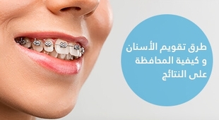 Magazine طرق تقويم الأسنان و كيفية المحافظة على النتائج