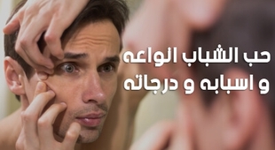 Magazine حب الشباب انواعه و اسبابه و درجاته