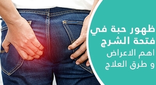 Magazine ظهور حبة في فتحة الشرج: اهم الاعراض و طرق العلاج