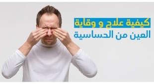 Makaleler كيفية علاج و وقاية العين من الحساسية