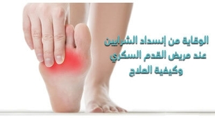 Makaleler الوقاية من إنسداد الشّرايين عند مريض القدم السّكّري وكيفيّة العلاج