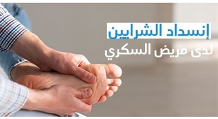 Magazine إنسداد الشّرايين لدى مريض السّكّري ( إعتلال شرايين الأطراف السّفلى)