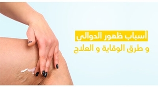 Magazine أسباب ظهور الدّوالي و طرق الوقاية و العلاج 