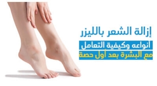 المجلة الطبية إزالة الشّعر باللّيزر : أنواعه وكيفيّة التّعامل مع البشرة بعد أوّل حصّة