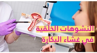 Magazine التشوّهات الخلقيّة في غشاء البكارة 