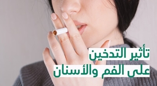 Makaleler تأثير التّدخين على الفم والأسنان 