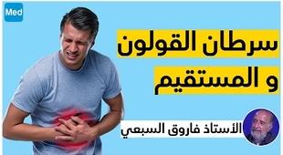 Magazine سرطان القولون و المستقيم