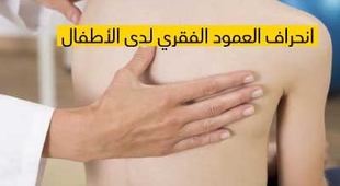 Magazine إنحراف العمود الفقري لدى الأطفال 
