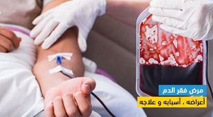 Makaleler مرض فقر الدم أعراضه ، أسبابه و علاجه