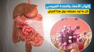 Makaleler إلتهاب الأمعاء والمعدة الفيروسي: كل ما تود معرفته حول هذا المرض