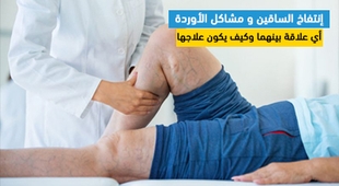 Magazine إنتفاخ الساقين و مشاكل الأوردة: أي علاقة بينهما وكيف يكون علاجها