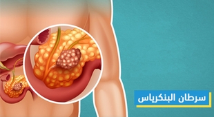 Magazine سرطان البنكرياس 