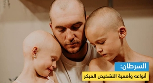 Makaleler السرطان: أنواعه وأهمية التشخيص المبكر