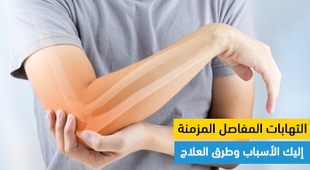 Magazine التهابات المفاصل المزمنة: إليك الأسباب وطرق العلاج