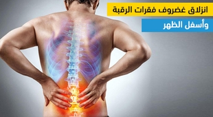 Magazine انزلاق غضروف فقرات الرقبة وأسفل الظهر