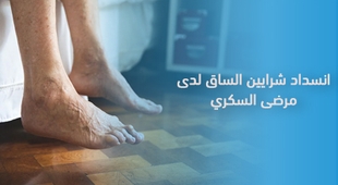 Makaleler انسداد شرايين الساق لدى مرضى السكري