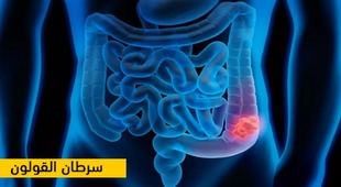 Magazine سرطان القولون