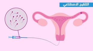 Magazine التلقيح الاصطناعي