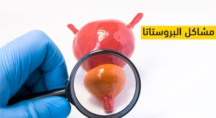 Makaleler مشاكل البروستاتا