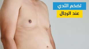 Magazine تضخم الثدي عند الرجال